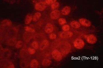 Phospho-SOX2 (Thr128) Antibody in Immunocytochemistry (ICC/IF)