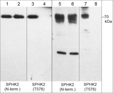 Phospho-SPHK2 (Thr578) Antibody in Western Blot (WB)
