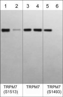 Phospho-TRPM7 (Ser1493) Antibody in Western Blot (WB)