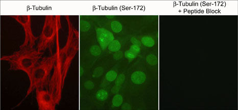 Phospho-beta Tubulin (Ser172) Antibody in Immunocytochemistry (ICC/IF)