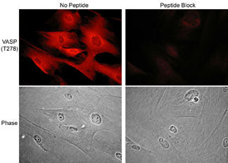 Phospho-VASP (Thr278) Antibody in Immunocytochemistry (ICC/IF)