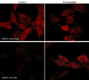 Phospho-WAVE1 (Tyr125) Antibody in Immunocytochemistry (ICC/IF)