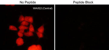 WAVE2 Antibody in Immunocytochemistry (ICC/IF)