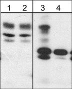 Phospho-WAVE2 (Tyr150) Antibody in Western Blot (WB)