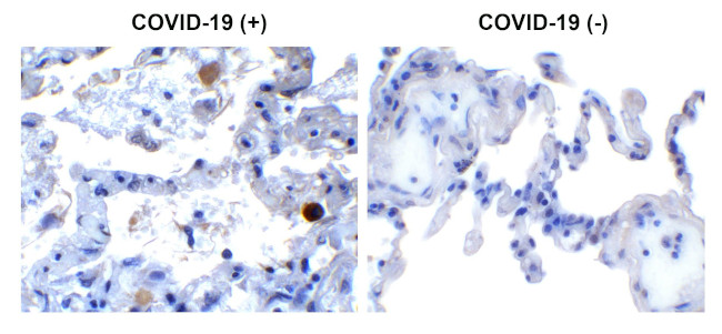 SARS-CoV-2 NSP13 Antibody in Immunohistochemistry (Paraffin) (IHC (P))