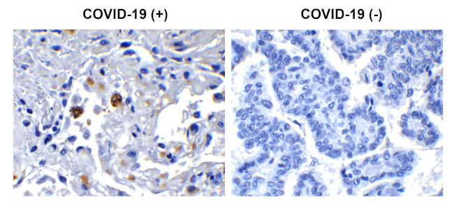 SARS-CoV-2 NSP13 Antibody in Immunohistochemistry (Paraffin) (IHC (P))