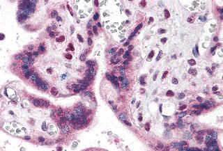 IRF2BP2 Antibody in Immunohistochemistry (Paraffin) (IHC (P))