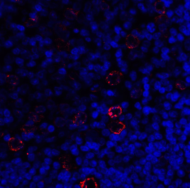 CD223 Antibody in Immunohistochemistry (Paraffin) (IHC (P))