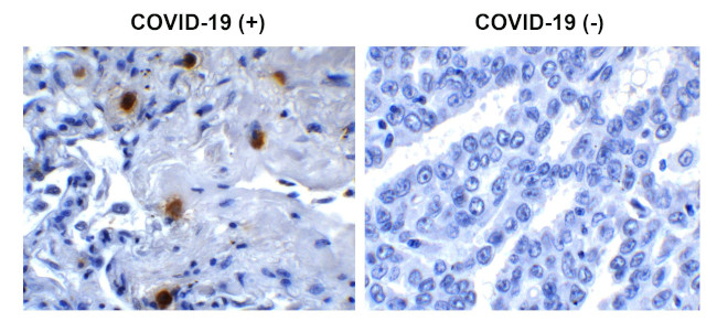 SARS-CoV-2 NSP10 Antibody in Immunohistochemistry (Paraffin) (IHC (P))