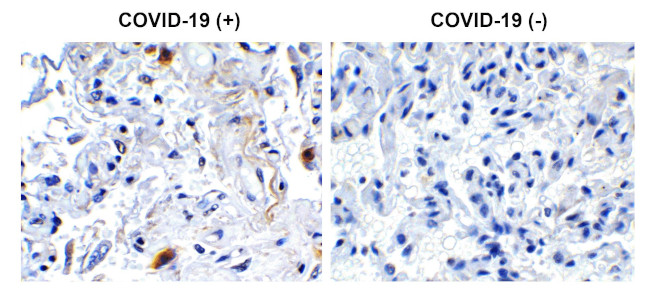 SARS-CoV-2 NSP2 Antibody in Immunohistochemistry (Paraffin) (IHC (P))