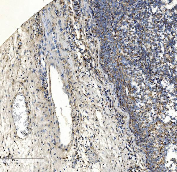 COL7A1 Antibody in Immunohistochemistry (Paraffin) (IHC (P))