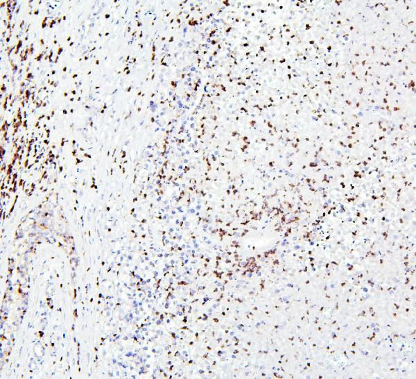 CRB1 Antibody in Immunohistochemistry (Paraffin) (IHC (P))