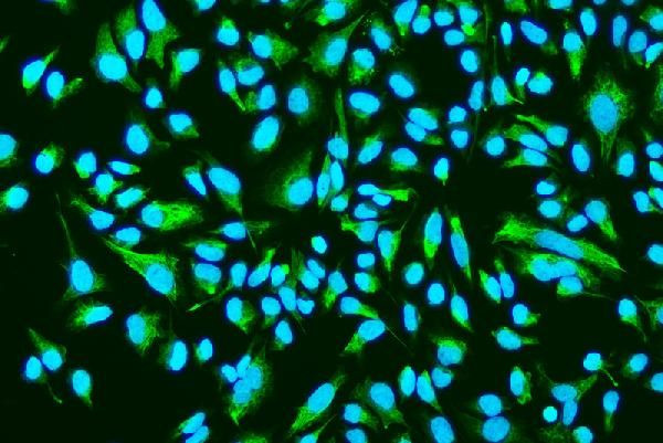 ASAH1 Antibody in Immunocytochemistry (ICC/IF)