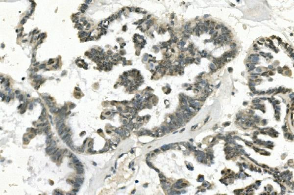 PHEX Antibody in Immunohistochemistry (Paraffin) (IHC (P))