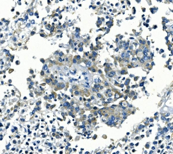 Kir6.1 (KCNJ8) Antibody in Immunohistochemistry (Paraffin) (IHC (P))