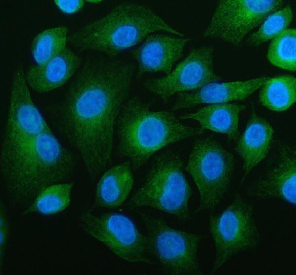 beta Tubulin Antibody in Immunocytochemistry (ICC/IF)