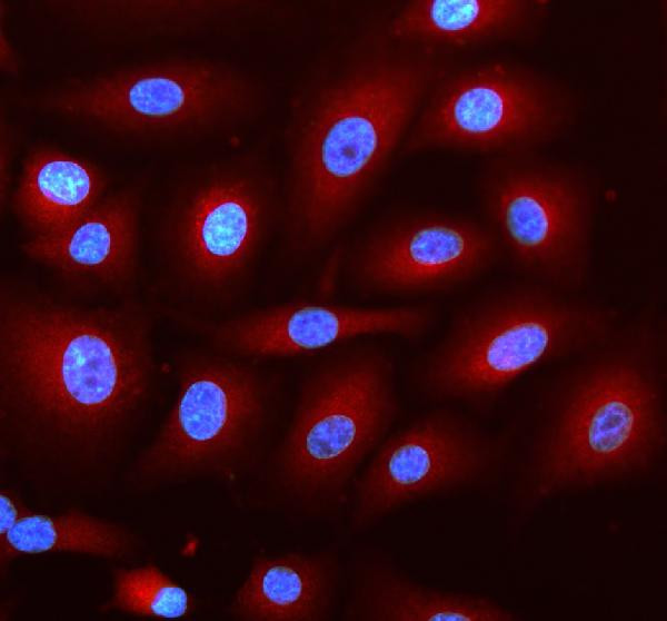 DNAJC6 Antibody in Immunocytochemistry (ICC/IF)
