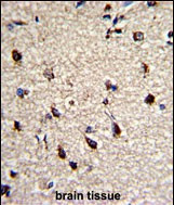 DPT Antibody in Immunohistochemistry (Paraffin) (IHC (P))
