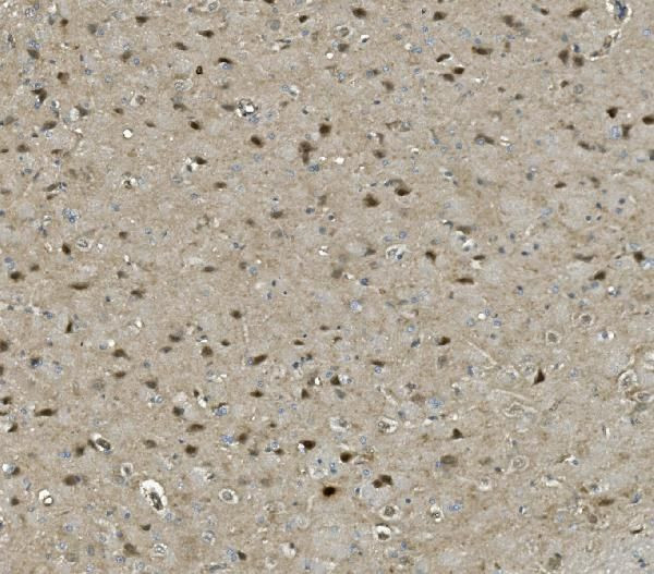 PRMT8 Antibody in Immunohistochemistry (Paraffin) (IHC (P))