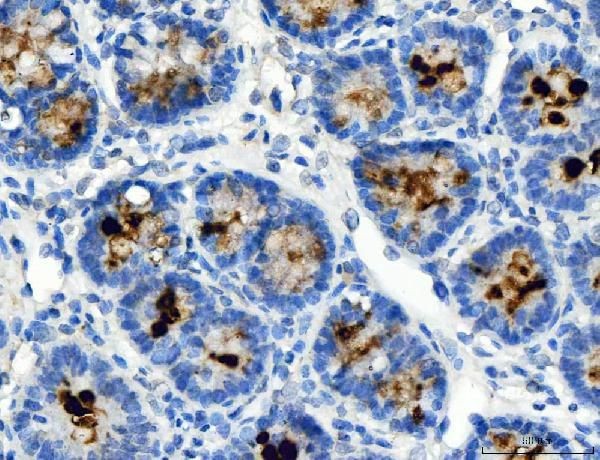 ATP4A Antibody in Immunohistochemistry (Paraffin) (IHC (P))
