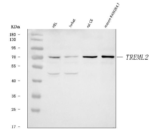 TREML2 Antibody in Western Blot (WB)