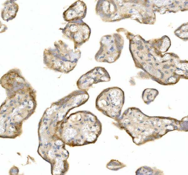 Ly-6E Antibody in Immunohistochemistry (Paraffin) (IHC (P))