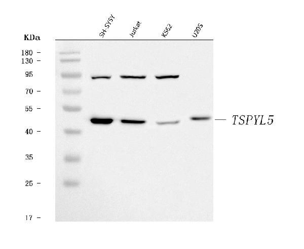 TSPYL5 Antibody in Western Blot (WB)