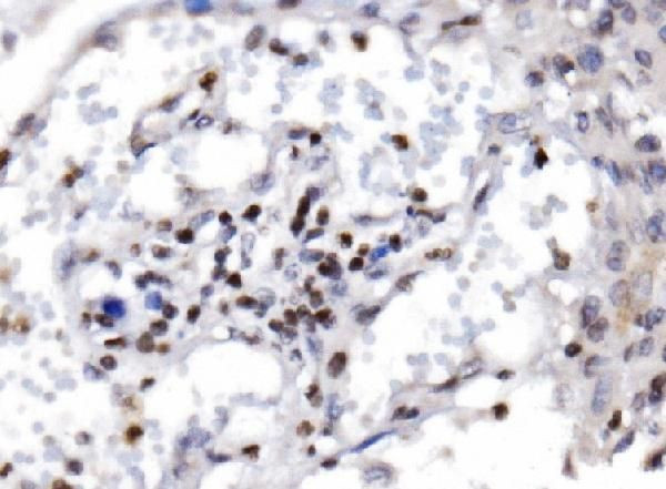 RAX2 Antibody in Immunohistochemistry (Paraffin) (IHC (P))