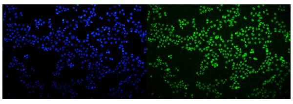 hnRNP H3 Antibody in Immunocytochemistry (ICC/IF)