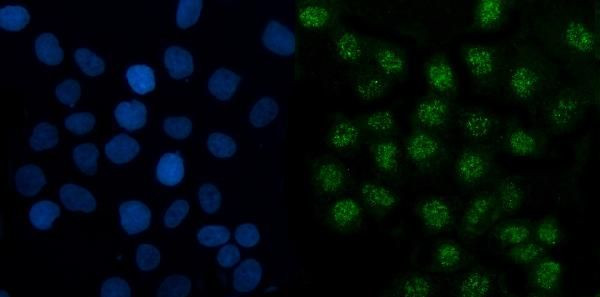 TMED5 Antibody in Immunocytochemistry (ICC/IF)