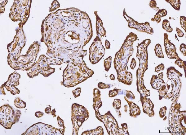 PKIB Antibody in Immunohistochemistry (Paraffin) (IHC (P))