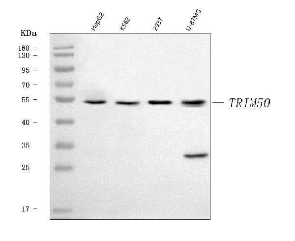 TRIM50 Antibody in Western Blot (WB)