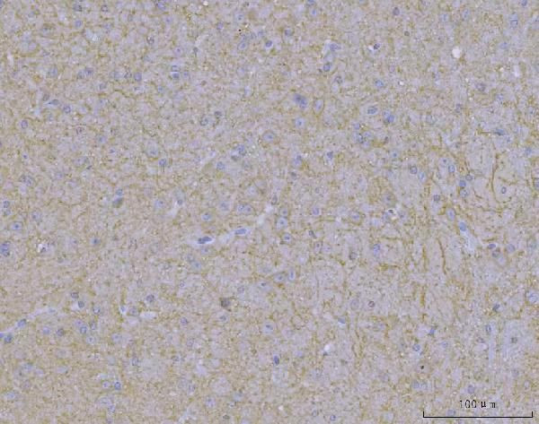 WDR7 Antibody in Immunohistochemistry (Paraffin) (IHC (P))