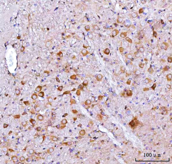 NMS Antibody in Immunohistochemistry (Paraffin) (IHC (P))