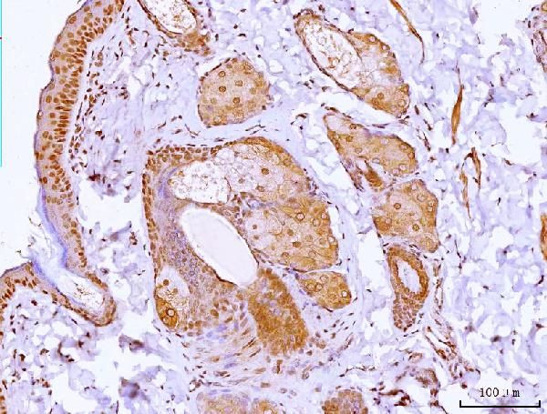 HOXC12 Antibody in Immunohistochemistry (Paraffin) (IHC (P))