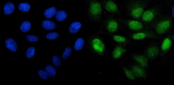 PHF21B Antibody in Immunocytochemistry (ICC/IF)