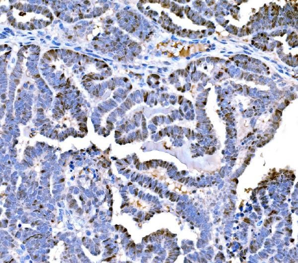 DPY19L1 Antibody in Immunohistochemistry (Paraffin) (IHC (P))