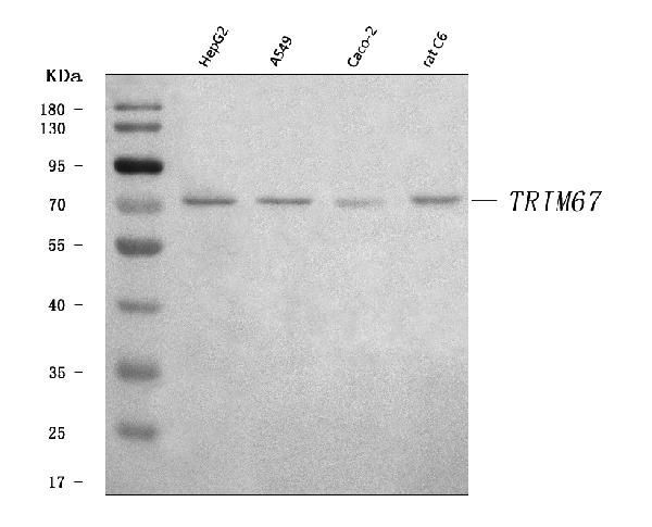 TRIM67 Antibody in Western Blot (WB)