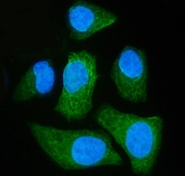 MCAR1/MCAR2 Antibody in Immunocytochemistry (ICC/IF)