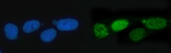 TIGD1 Antibody in Immunocytochemistry (ICC/IF)