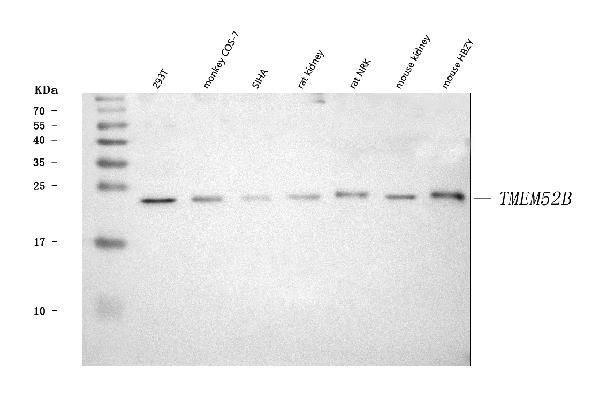 TMEM52B Antibody in Western Blot (WB)