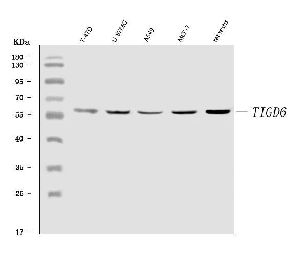 TIGD6 Antibody in Western Blot (WB)