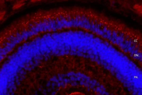 Usherin Antibody in Immunohistochemistry (Frozen) (IHC (F))