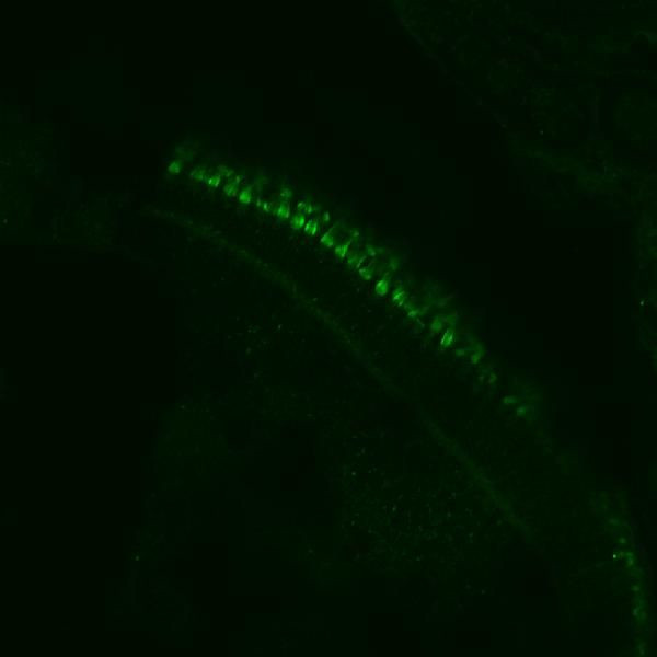 cdhr1a Antibody in Immunohistochemistry (Paraffin) (IHC (P))