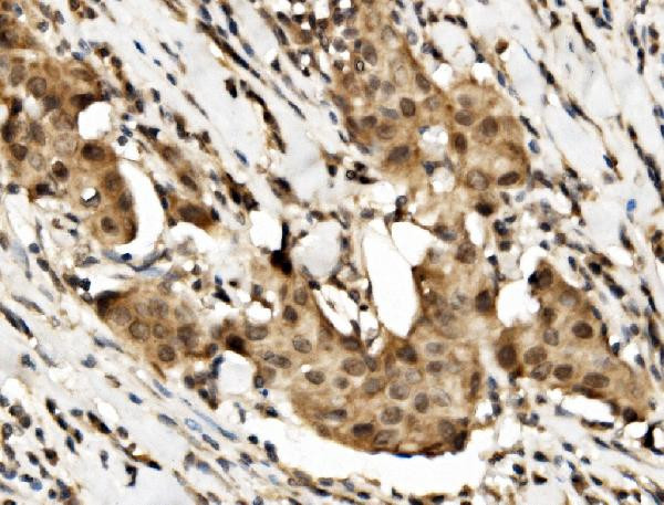 DRB1 Antibody in Immunohistochemistry (Paraffin) (IHC (P))
