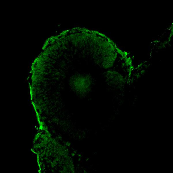 ZNF503 Antibody in Immunohistochemistry (Paraffin) (IHC (P))