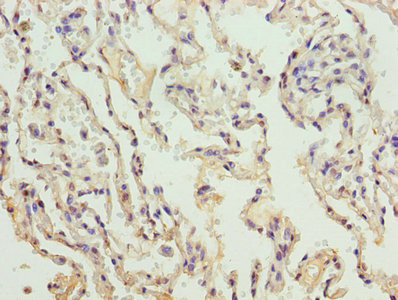 COL4A3 Antibody in Immunohistochemistry (Paraffin) (IHC (P))