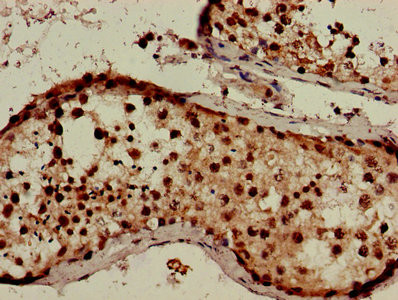 CXorf1 Antibody in Immunohistochemistry (Paraffin) (IHC (P))