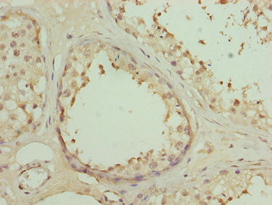 DSCR9 Antibody in Immunohistochemistry (Paraffin) (IHC (P))