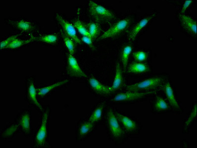 c-Raf Antibody in Immunocytochemistry (ICC/IF)